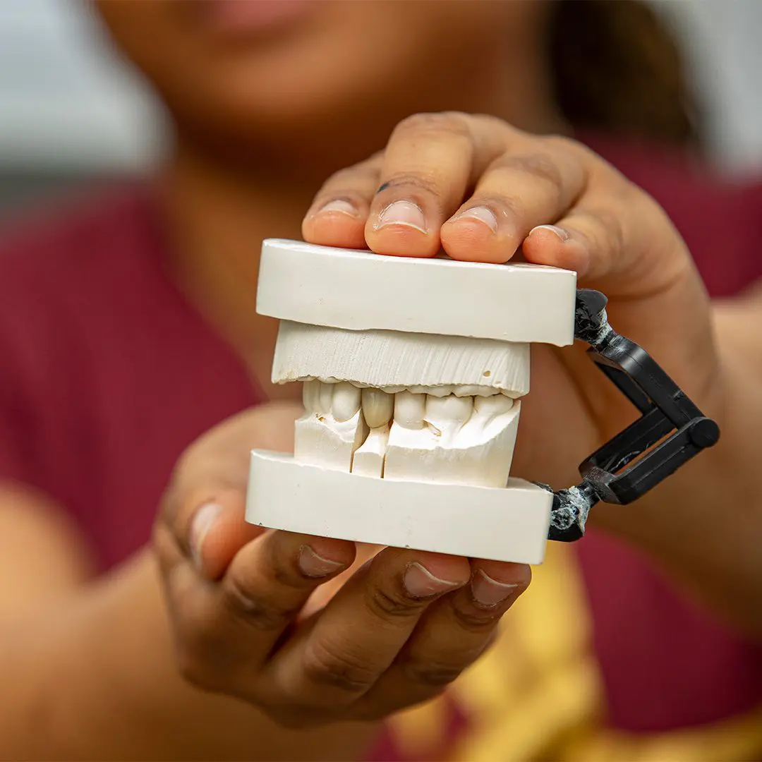 Implant Supported Dentures | Masterpiece Smiles