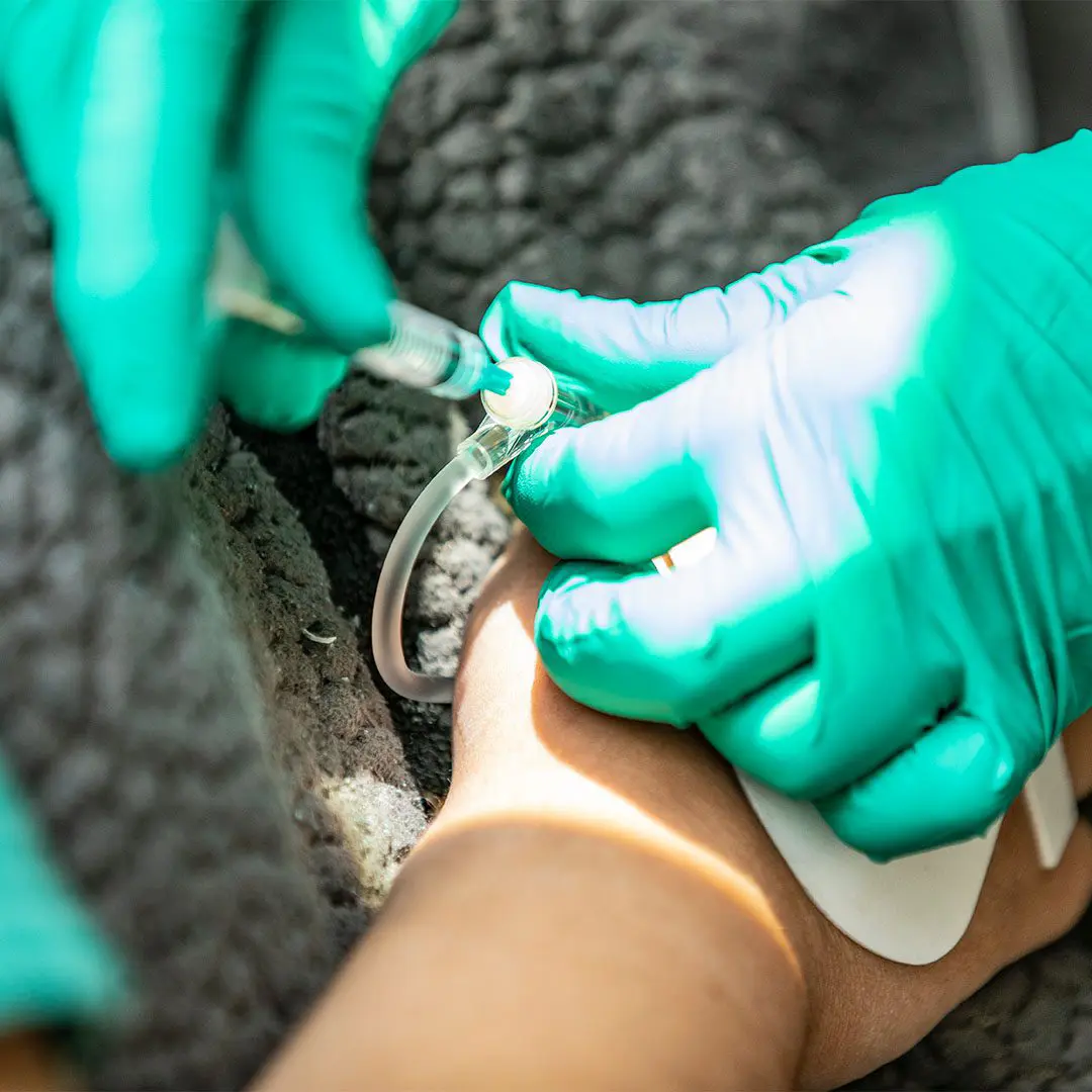 Simple & Painless IV Sedation | Masterpiece Smiles